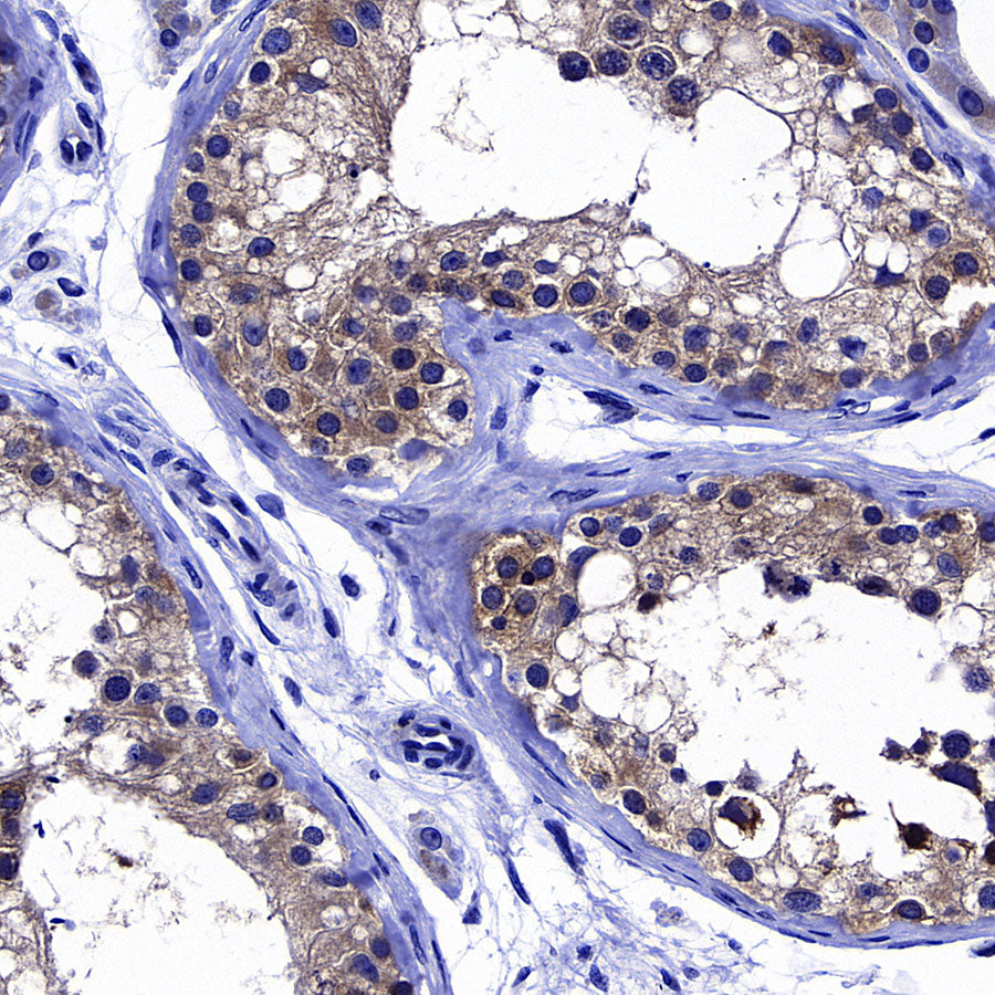 GFPT1 Recombinant Rabbit mAb (S-4752-19)
