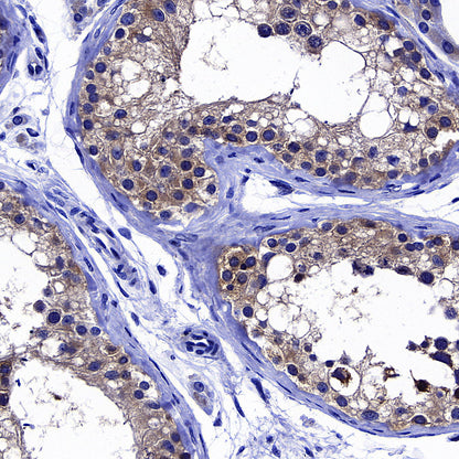 GFPT1 Recombinant Rabbit mAb (S-4752-19)