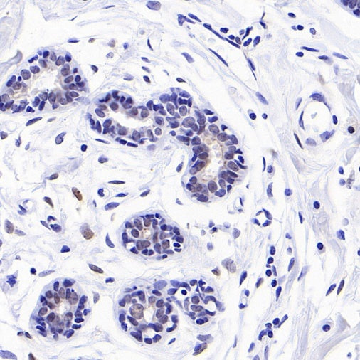 CDKN2A/p16 INK4A Recombinant Rabbit mAb (S-4676)
