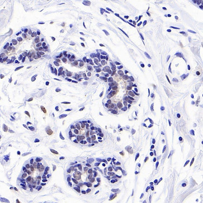 CDKN2A/p16 INK4A Recombinant Rabbit mAb (S-4676)