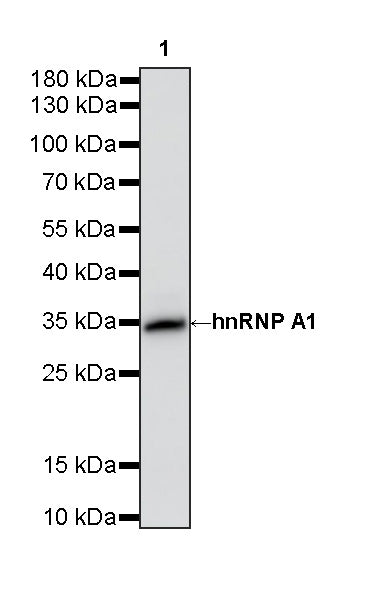 hnRNP A1 Recombinant Rabbit mAb