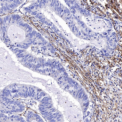 TMEM119 Recombinant Rabbit mAb (S-1040-14)