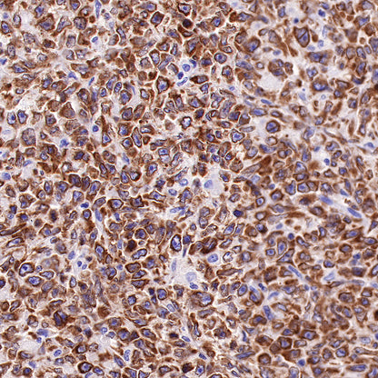 S-RMab® Bcl-2 Recombinant Rabbit mAb,PBS Only (SDT-R160)