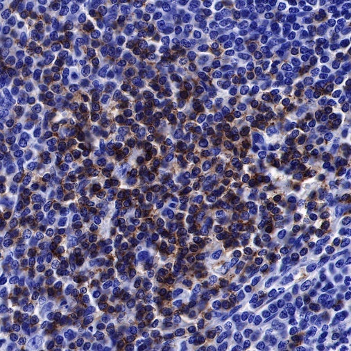 Lck Recombinant Rabbit mAb (SDT-316-15)