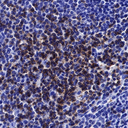 Lck Recombinant Rabbit mAb (SDT-316-15)