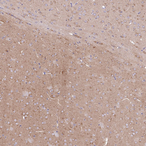 14-3-3 zeta Recombinant Rabbit mAb (S-1092-31)