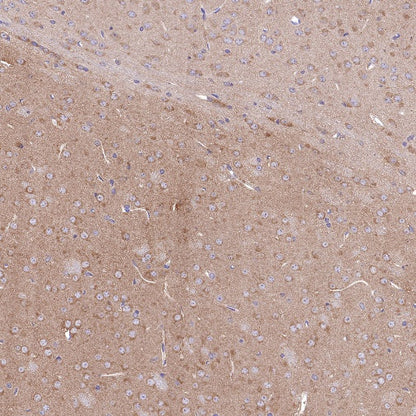 14-3-3 zeta Recombinant Rabbit mAb (S-1092-31)