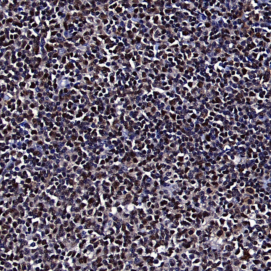 RPA3 Recombinant Rabbit mAb (S-4552-20)