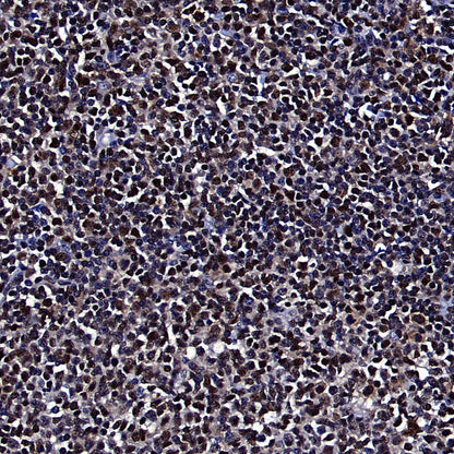 RPA3 Recombinant Rabbit mAb (S-4552-20)