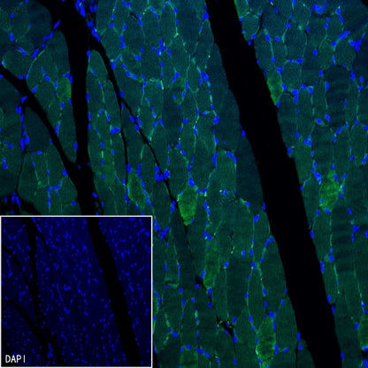 MYH7 Recombinant Rabbit mAb ,PBS Only (SDT-2936-44)