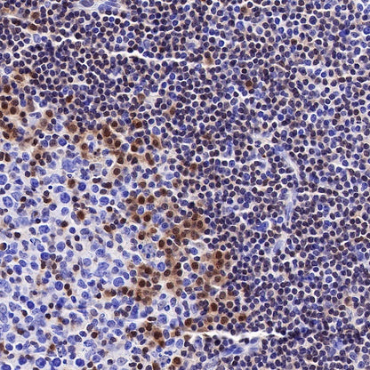 p27 Recombinant Rabbit mAb (SDT-R350)