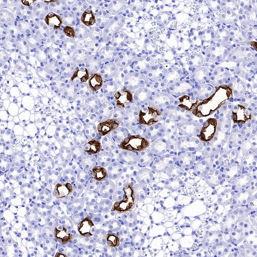 AQP2 Recombinant Rabbit mAb (SDT-2149-19)