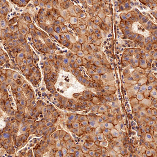 Flotillin 1 Rabbit Polyclonal Antibody