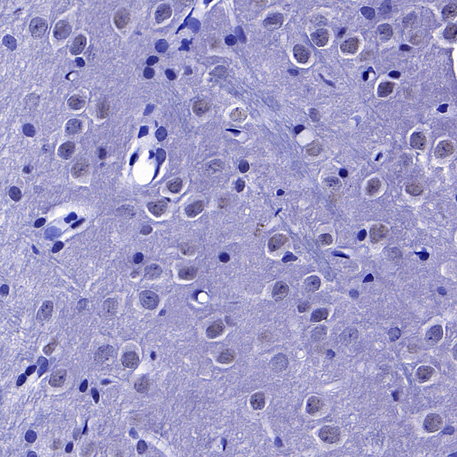 SC35 Recombinant Mouse mAb (S-5700)