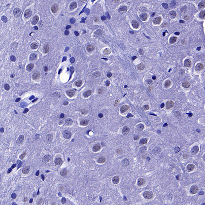 SC35 Recombinant Mouse mAb (S-5700)
