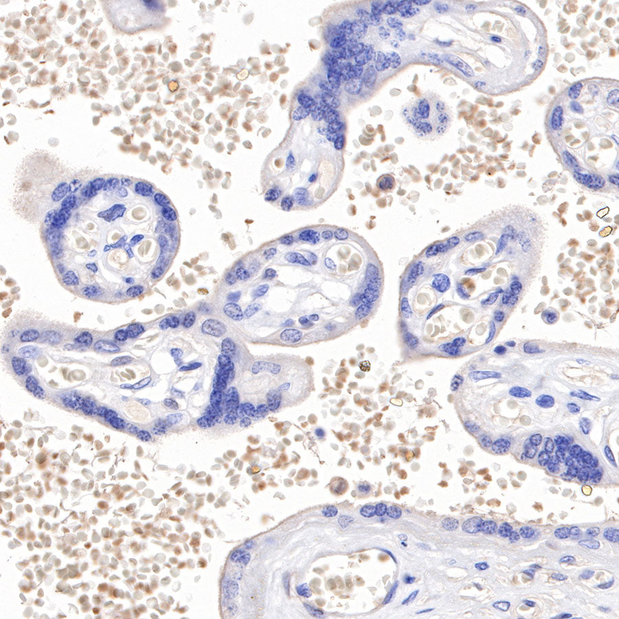 Hemoglobin Recombinant Rabbit mAb (SDT-193-71)