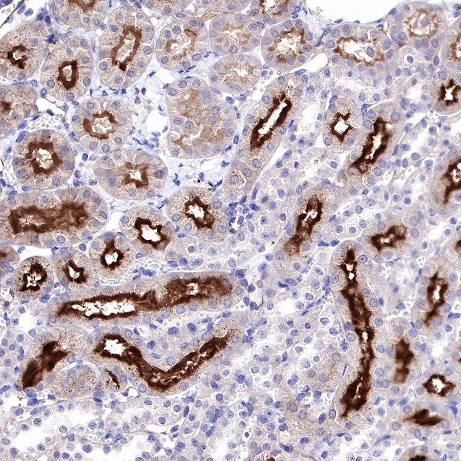 CD73 Recombinant Rabbit mAb (SDT-218-52)