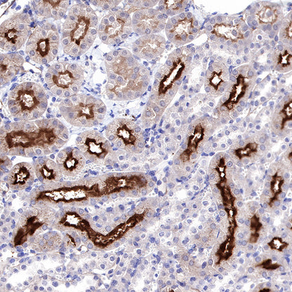 CD73 Recombinant Rabbit mAb (SDT-218-52)