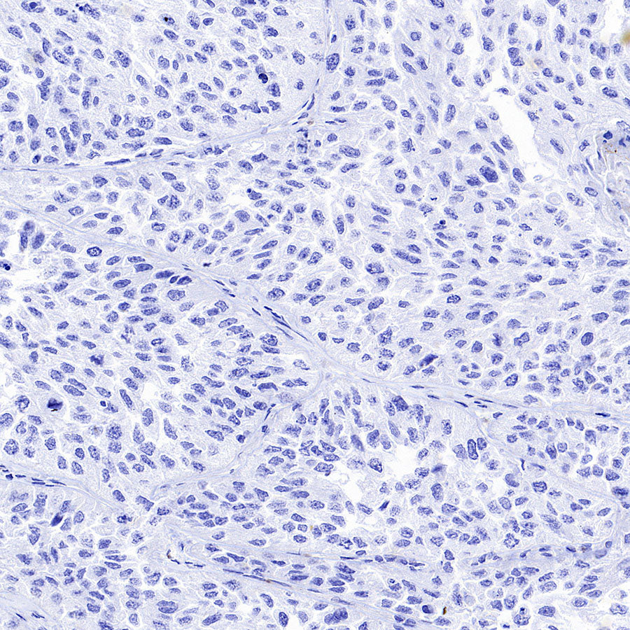 ARR3 Recombinant Rabbit mAb (S-3290-27)