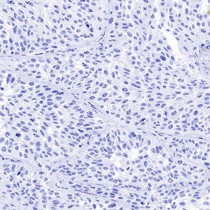 ARR3 Recombinant Rabbit mAb (S-3290-27)