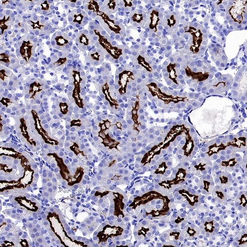 Angiotensin Converting Enzyme 1 Recombinant Rabbit mAb (SDT-2662-122)