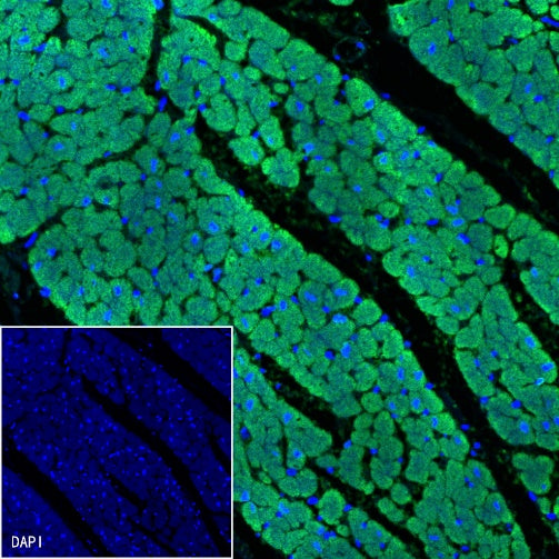 Cardiac Troponin I Recombinant Rabbit mAb (S-1352-28)