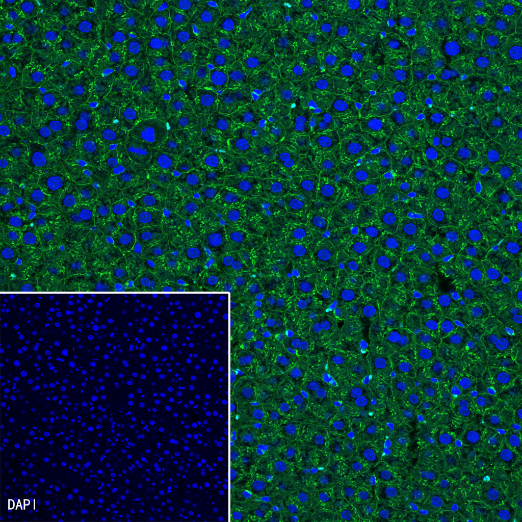 β-Catenin Recombinant Rabbit mAb,PBS Only (SDT-336-23)