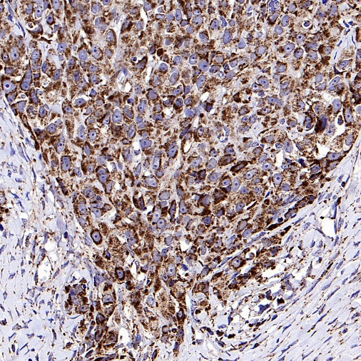Fumarate hydratase Recombinant Rabbit mAb (SDT-2394-36)