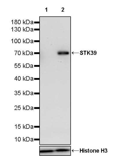 STK39 Recombinant Rabbit mAb (S-3630-15)
