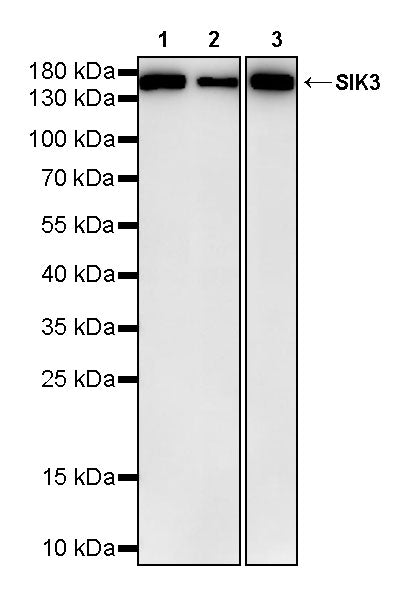 SIK3 Rabbit Polyclonal Antibody