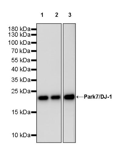 Park7/DJ-1 Recombinant Rabbit mAb (S-980-144)