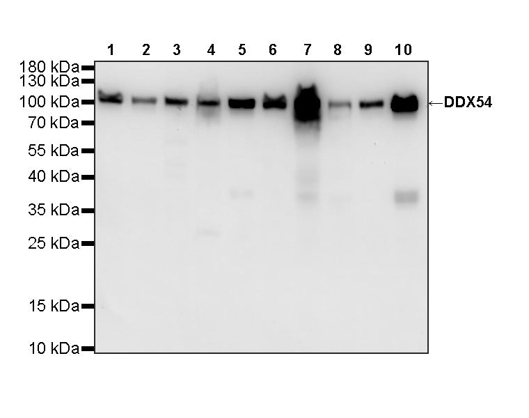 DDX54 Recombinant Rabbit mAb (S-4550-54)