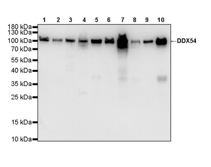 DDX54 Recombinant Rabbit mAb (S-4550-54)