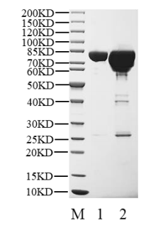 AKT1 (E17K) GST Tag Protein, Human