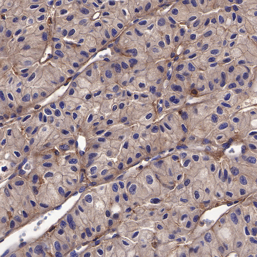 Galectin-3 Recombinant Rabbit mAb (SDT-370-111)