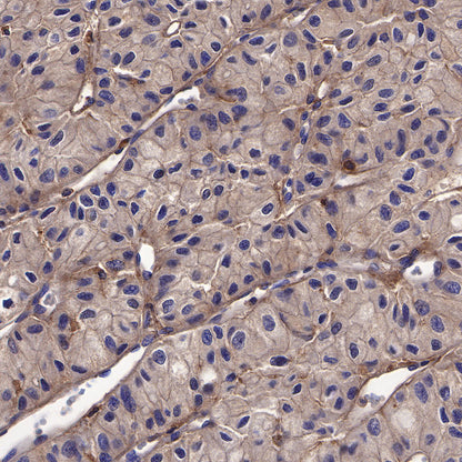 Galectin-3 Recombinant Rabbit mAb (SDT-370-111)