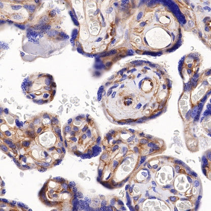 B7-H3 Recombinant Rabbit mAb (SDT-249-26)