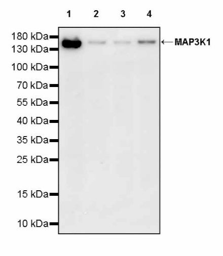 MAP3K1 Recombinant Rabbit mAb (S-3097-61)