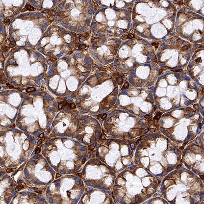 HLA-E Recombinant Rabbit mAb (S-1081-62)