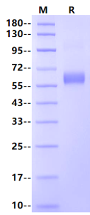 MMP-9 His Tag Protein, Human