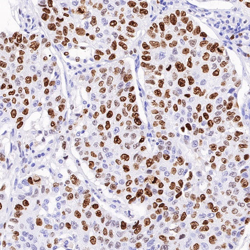 S-RMab® Ki67 Recombinant Rabbit mAb (SDT-10002)