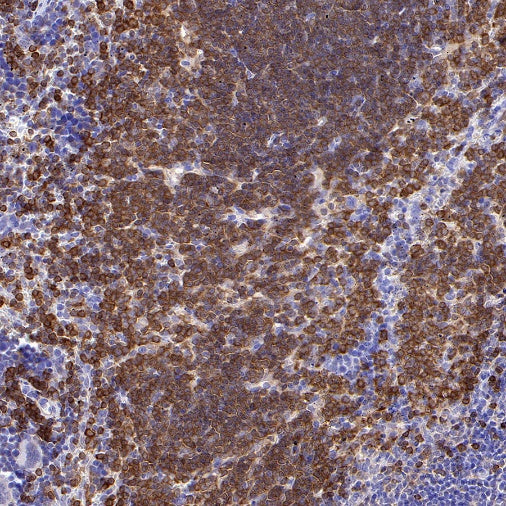 BANK1 Recombinant Rabbit mAb (SDT-2265-37)