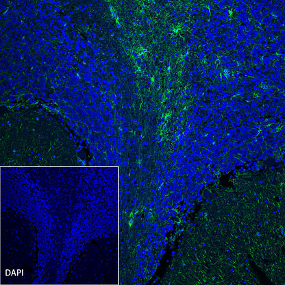 GFAP Recombinant Rabbit mAb (SDT-306-10)