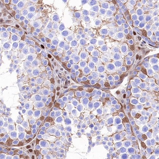 p27 Recombinant Rabbit mAb (SDT-R350)