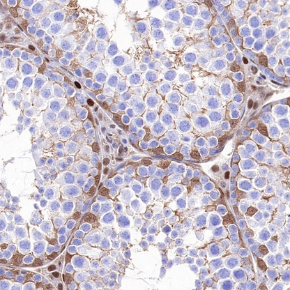 p27 Recombinant Rabbit mAb (SDT-R350)