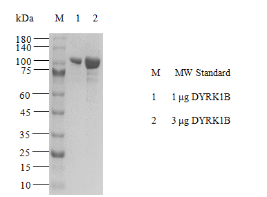 DYRK1B GST&Flag Tag Protein, Human