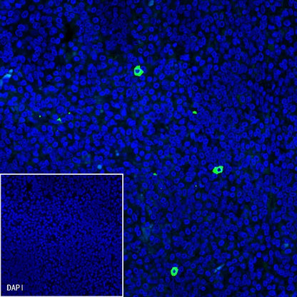 Human IgG4 Recombinant Rabbit mAb (S-1140-53)