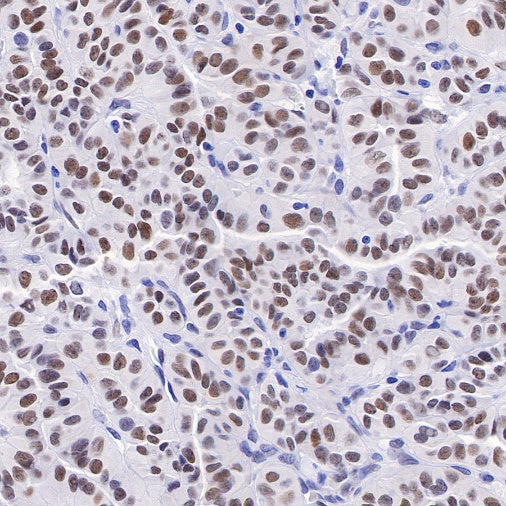 APE Recombinant Rabbit mAb (S-R349)
