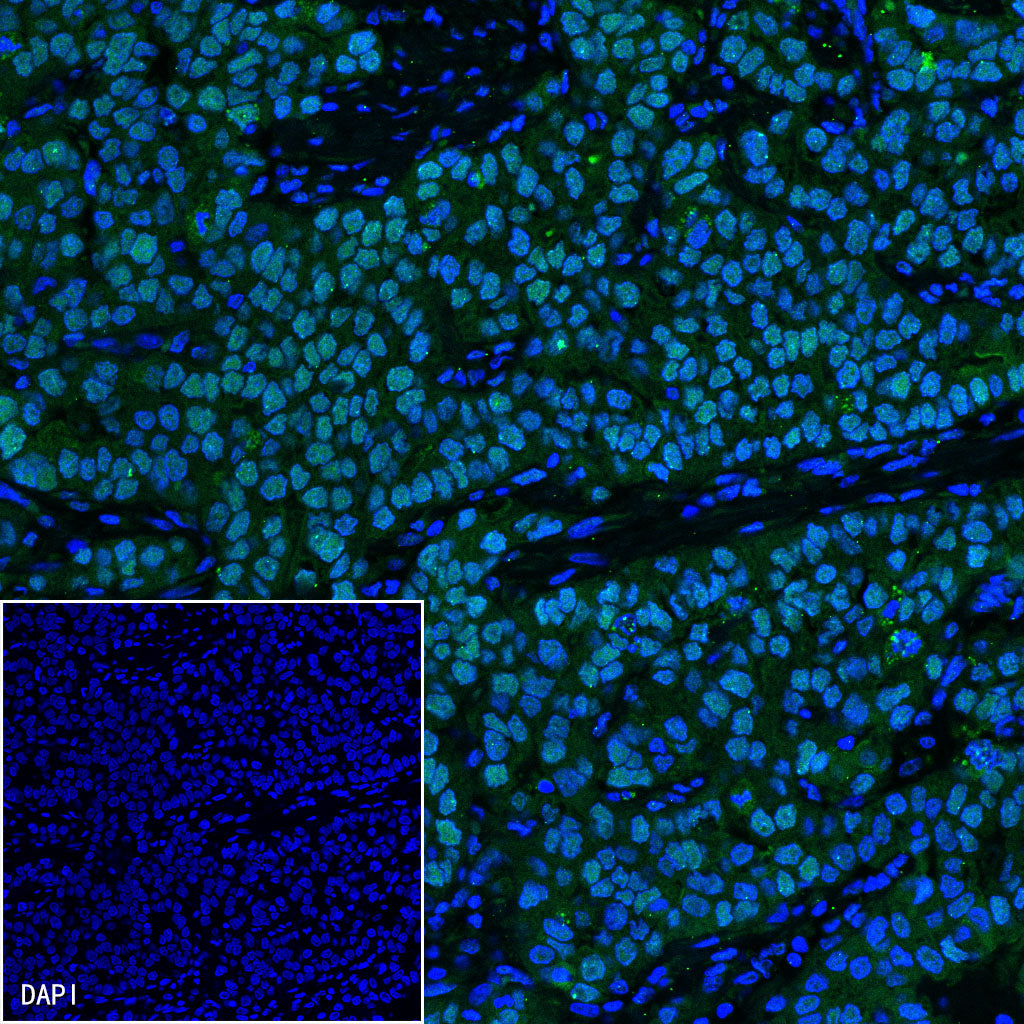 MSH2 Recombinant Rabbit mAb (SDT-037-20)