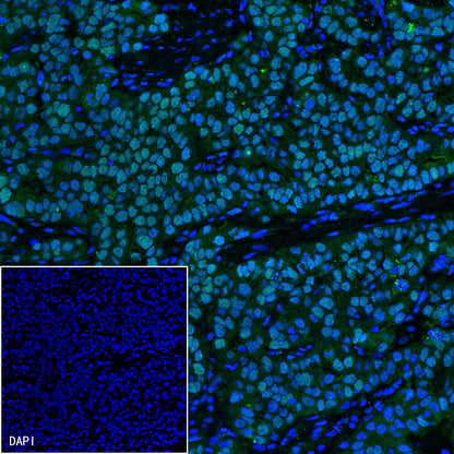 MSH2 Recombinant Rabbit mAb (SDT-037-20)